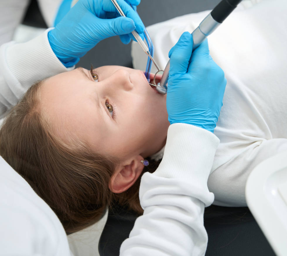 Hipomineralización Molar Incisivo (HMI): Manchas en los dientes que alertan sobre caries y fracturas