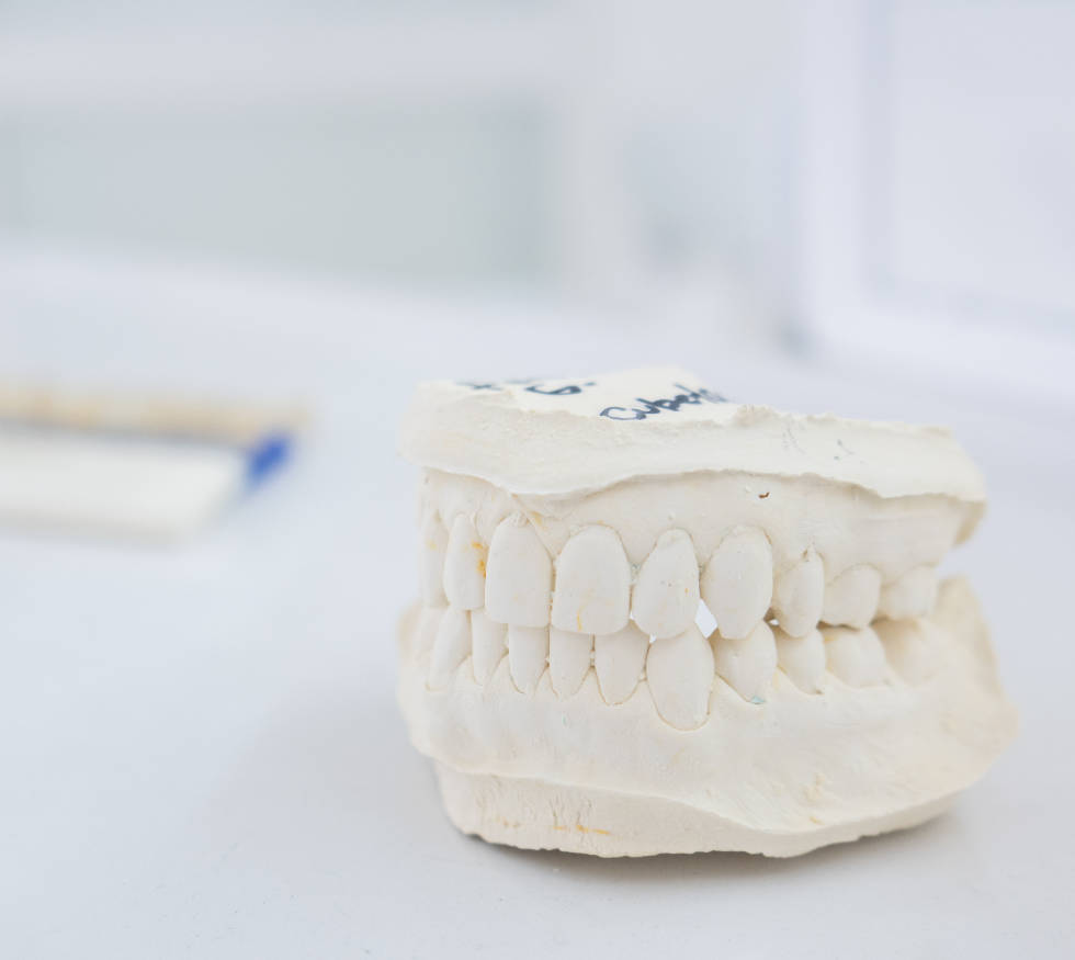 Urgencias Odontológicas:&nbsp;Restauraciones cervicales en ionómero de vidrio en pacientes con sensibilidad