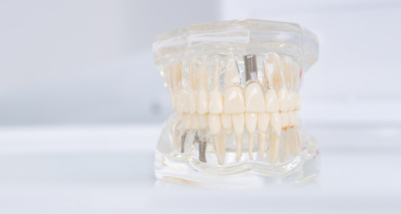 Rehabilitación oral