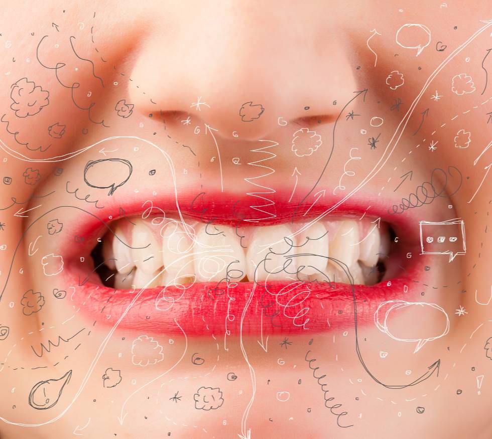 Bruxismo severo: cuando apretar los dientes se convierte en una urgencia odontológica.