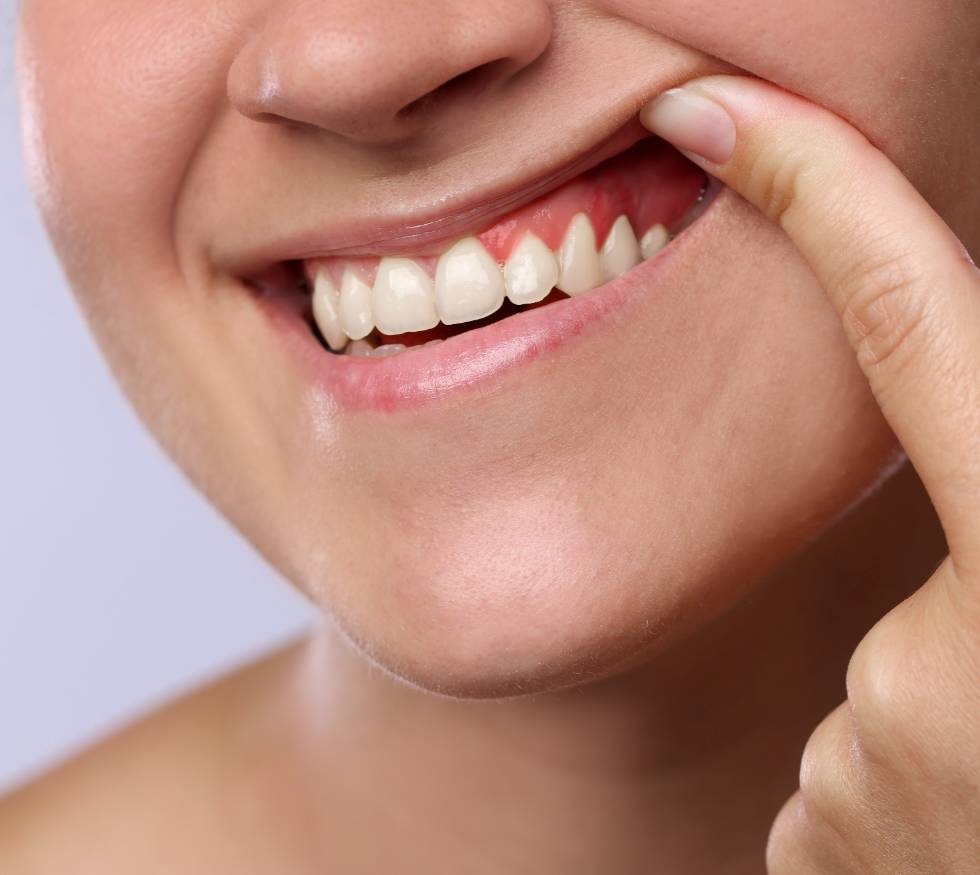 Encías que se retraen: por qué ocurre y cómo tratarlo