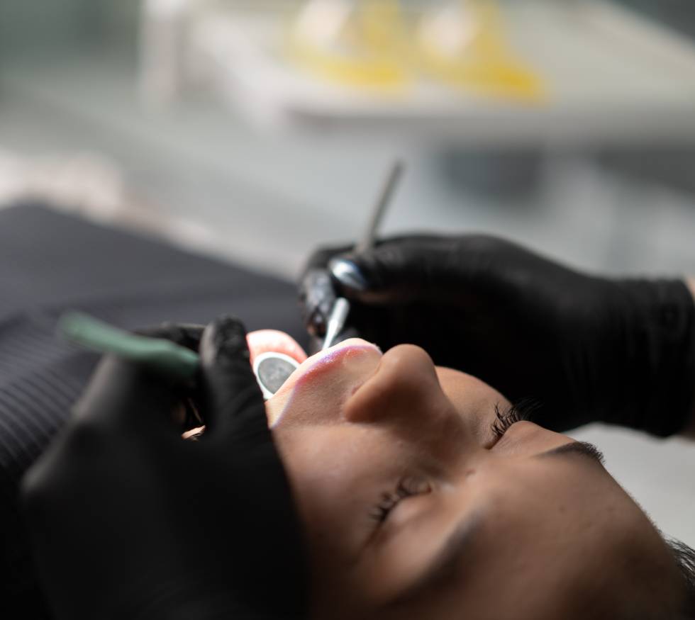 Errores comunes en tratamientos estéticos dentales