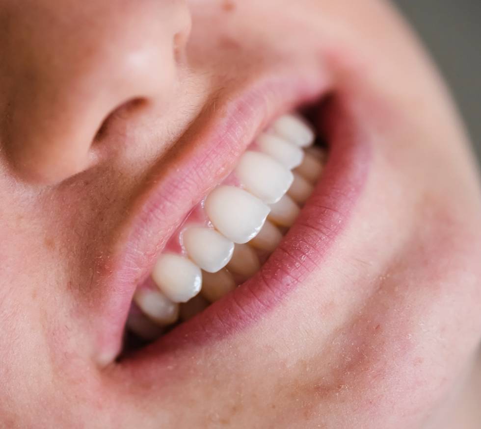 ¿Por qué se desgastan los dientes con el tiempo?